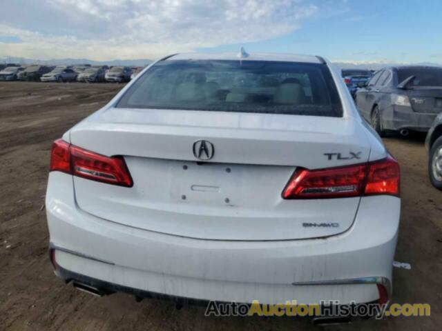 ACURA TLX, 19UUB3F3XLA000635