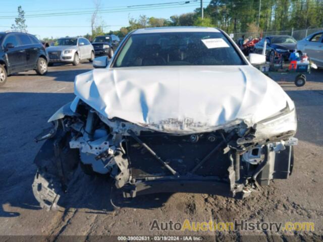 ACURA TLX, 19UUB2F35HA004822