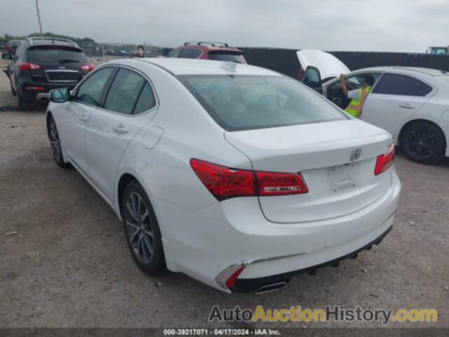 ACURA TLX, 19UUB2F32KA003182